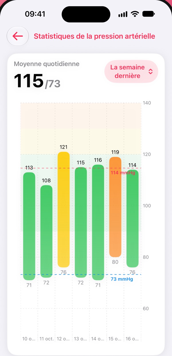 Écran de Pressure Control: Des graphiques limpides